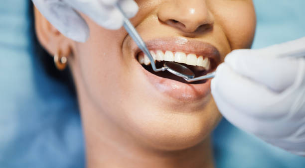 Best Emergency Tooth Extraction in Riverdale, IL