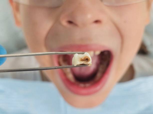 Best Weekend Emergency Dentist in Riverdale, IL